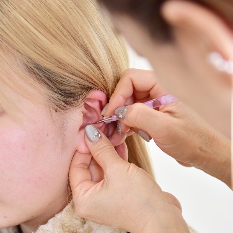 耳つぼ施術　風景